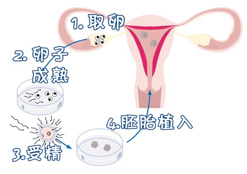 一般不妊検査・タイミング療法